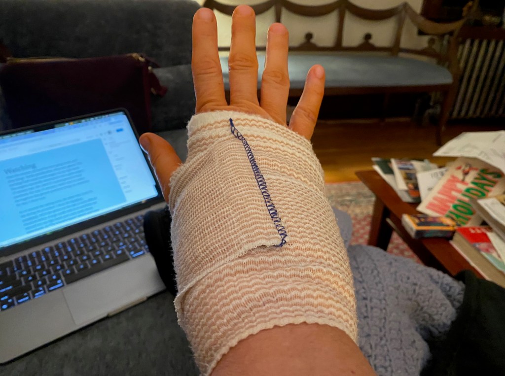 bandaged wrist after carpel tunnel surgery